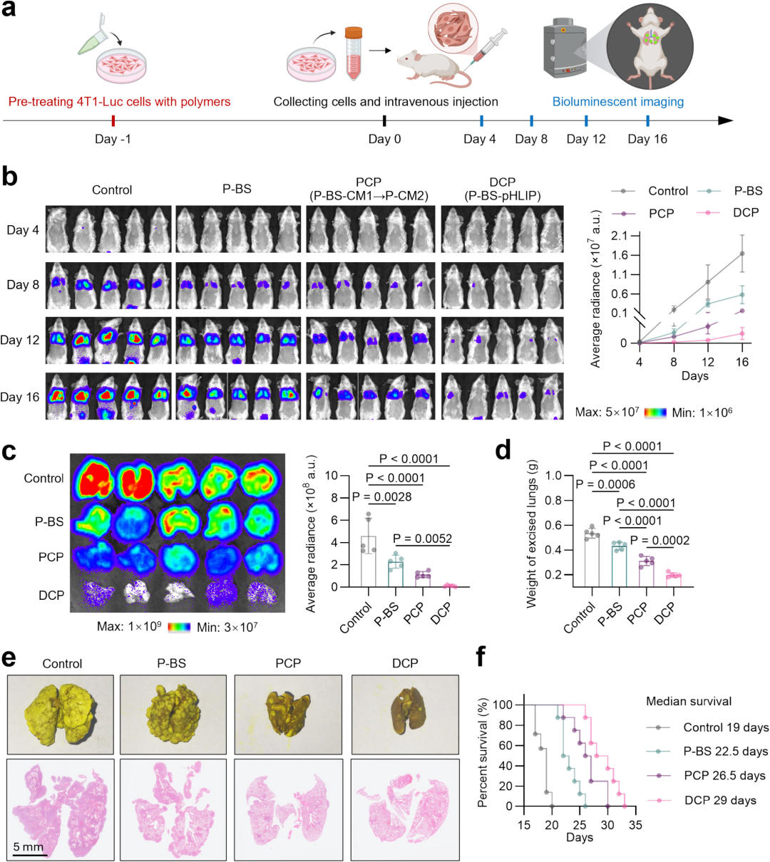 Fig.4 播散性 TNBC 转移模型